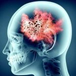 เผยความลับ "สวิตช์ทำลายตัวเอง" ของภูมิคุ้มกัน และวิกฤตพยาธิในสมอง